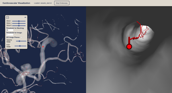 Cardiovascular Visualization
